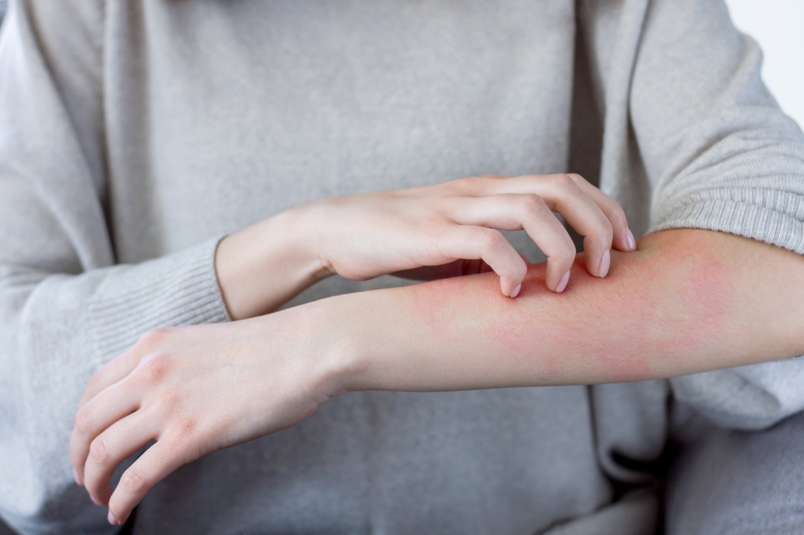 A provider examining a skin rash at Atlanta Urgent Care