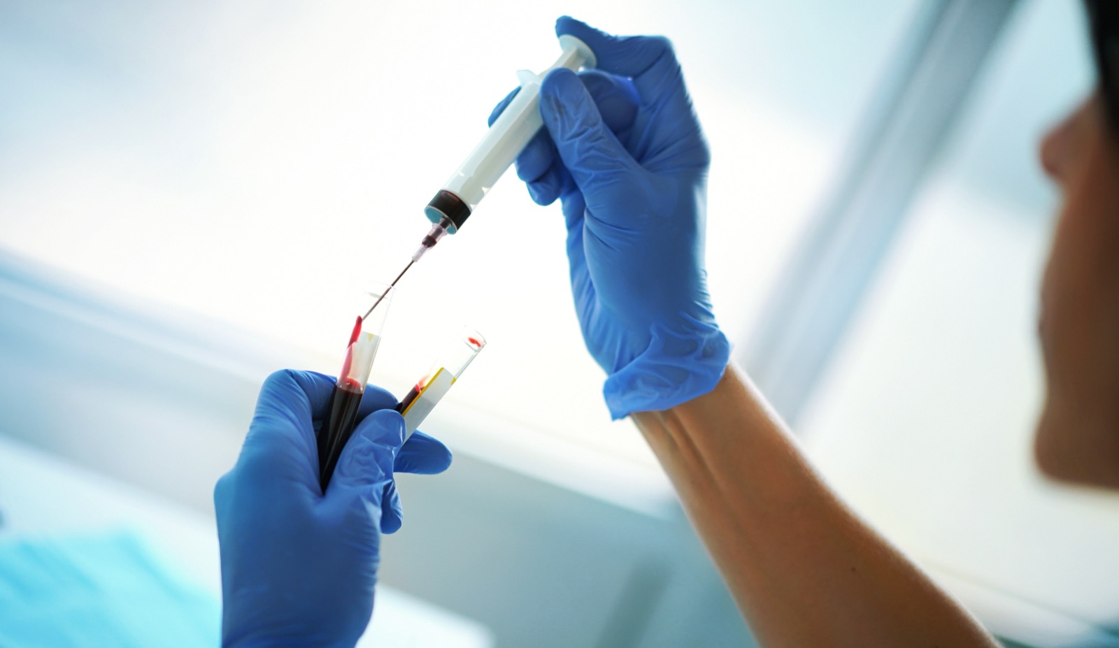 Discreet, confidential STD testing at Atlanta Urgent Care